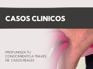Casos clinicos BGG